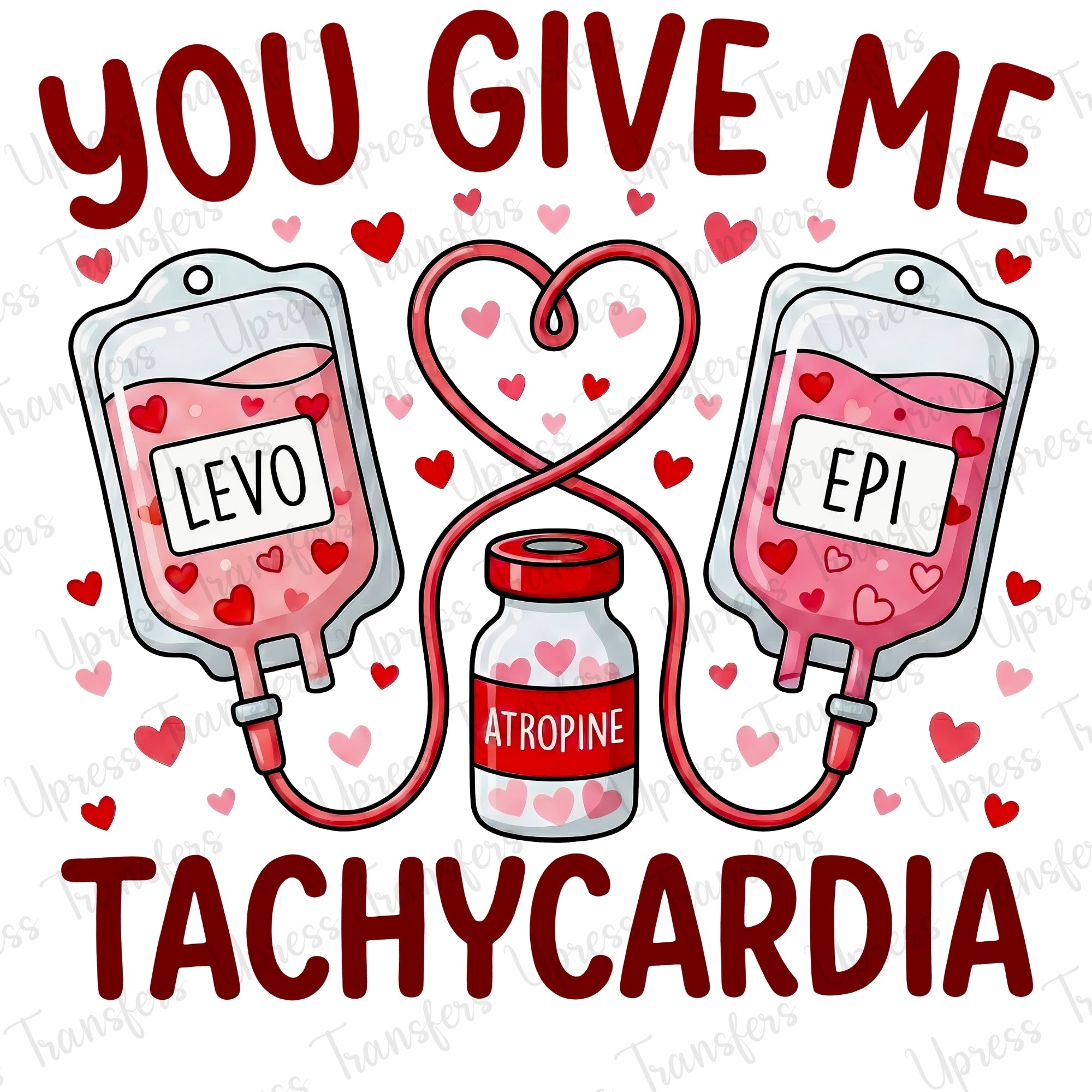 Tachycardia